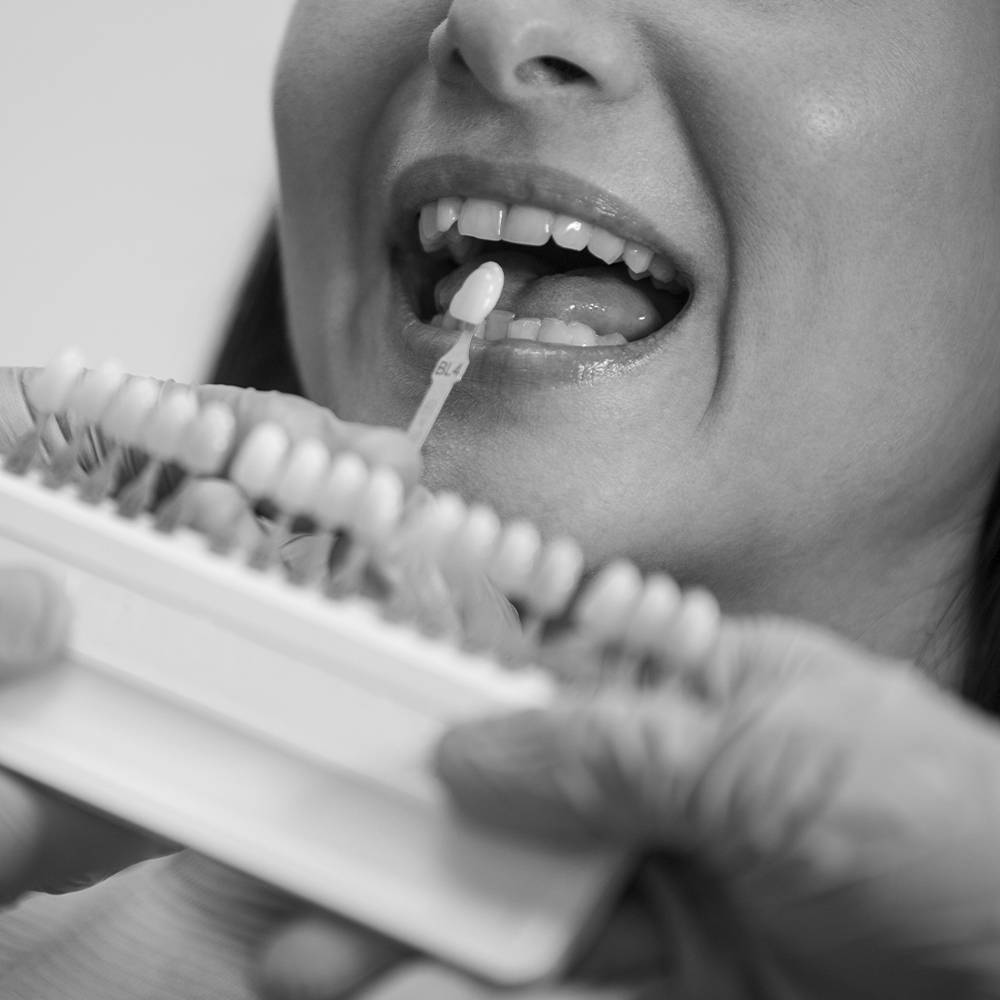 Estética dental avanzada