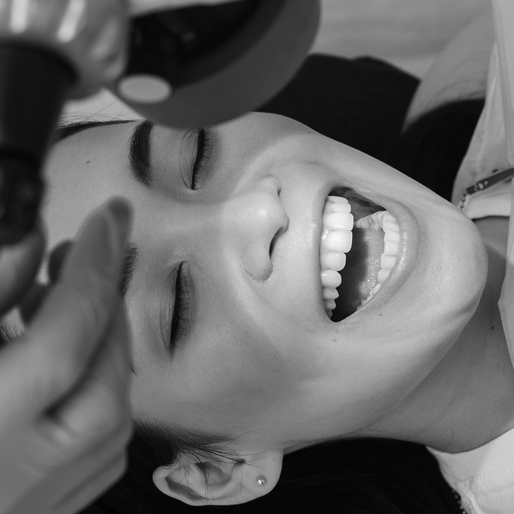 Resultado diseño de sonrisa
