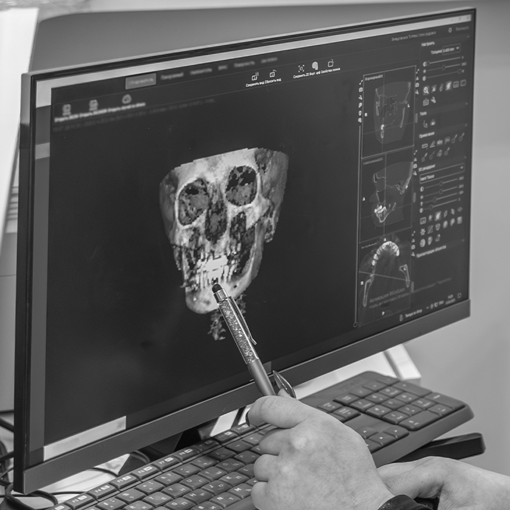Diagnóstico 3D