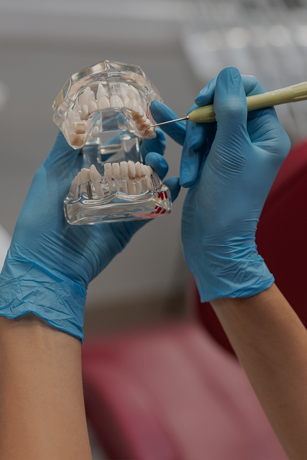 Implantes dentales en Polanco CDMX