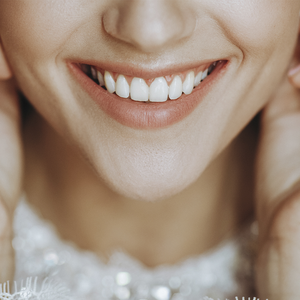 Clínica Smile Gallery
